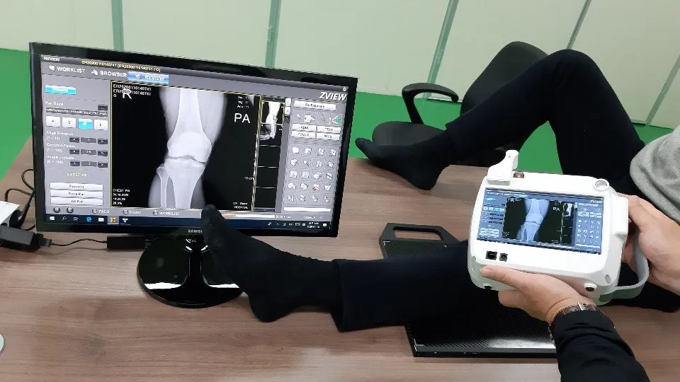 Maven HandHeld X-ray